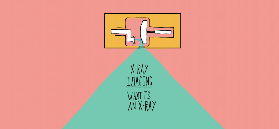 What Is an X-ray